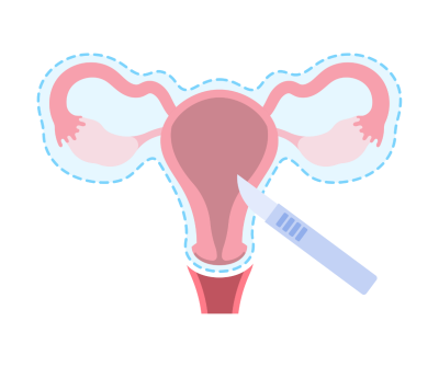 illustration of a uterus